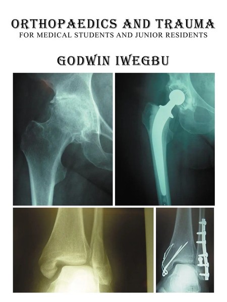 Orthopaedics And Trauma For Medical Students And Junior Residents | Iwegbu-image