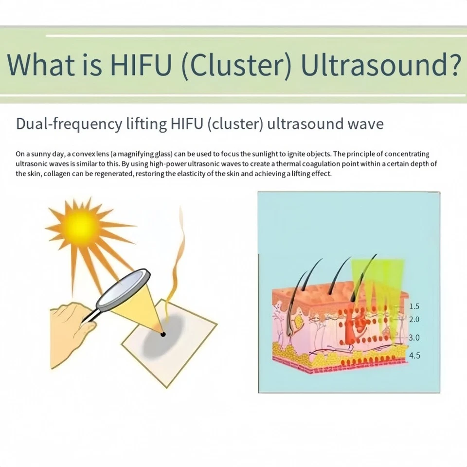 Hifu Hautstraffung Gesichtslifting Abnahme Maschine Anti-Aging Schönheitsgerät - Bild 3 von 4