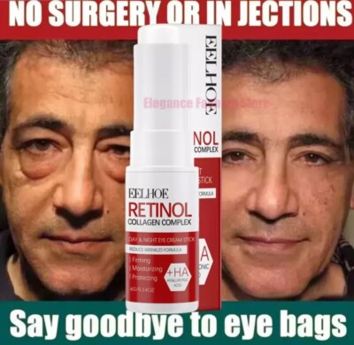 Instant Eye Bag Remove Eye Cream anti Fat Particles Dark Circles Puffiness Fade 