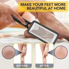 1 Pcs Foot File Scrubber Professional Rasp Heel Grater Hard Dead Skin Callus Rem