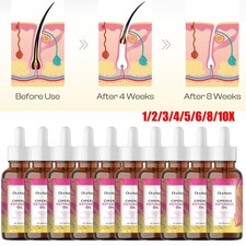 5/10 Pack Cyperus Rotundus Oil for Hair Removal Reducing Body Hair Growth 60ml