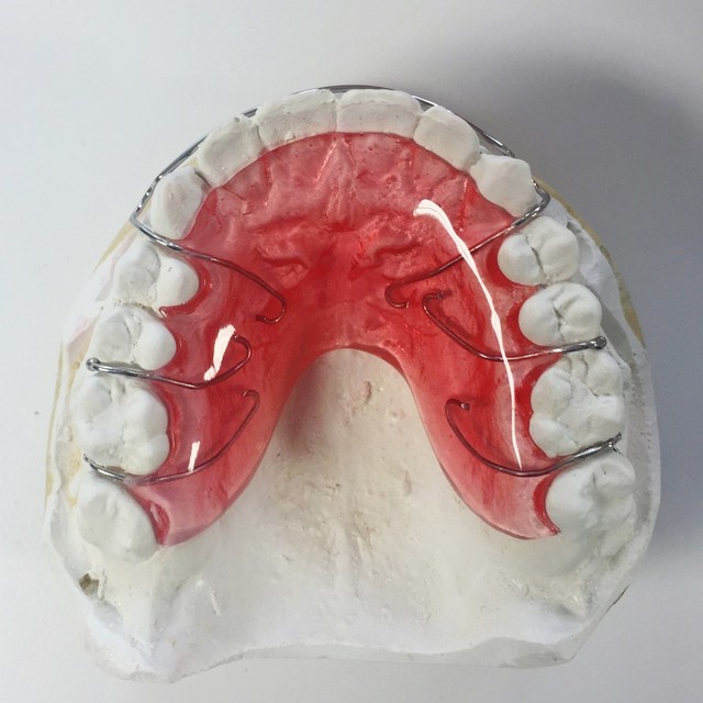 Dental Dentaurum Ball Retainer Clasps Orthodontic Tooth Hold Position