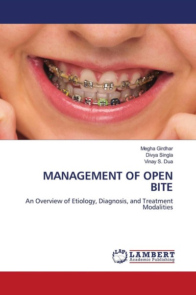 Management OF Open Bite Megha Girdhar-image