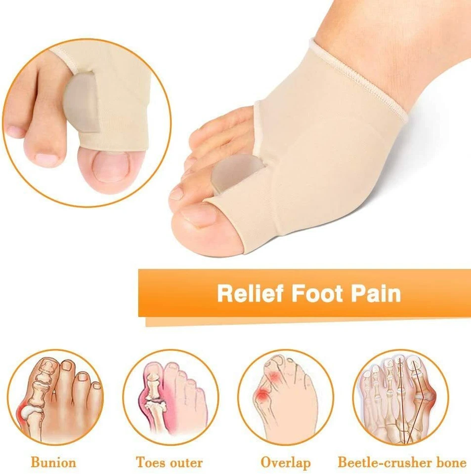 Separador de dedos Hallux Valgus juanete corrector ortopédico pies alivio del dolor manga Foto 2 de 4