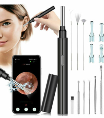 Kabelloser Ohrenschmalzentferner mit HD Kamera Smart Ohrendoskop für präzise Reinigung