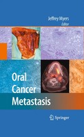 Oral Cancer Metastasis Jeffrey Myers Taschenbuch Xviii Englisch 2014 Springer