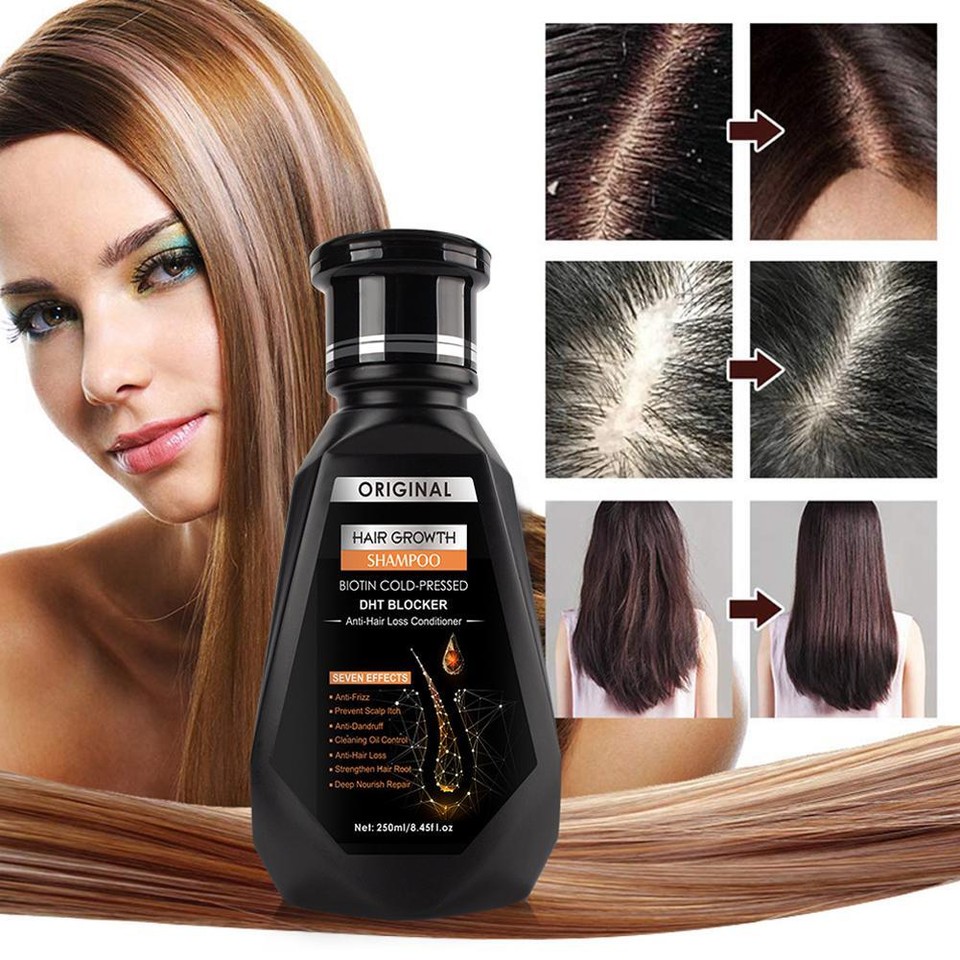 250ml Anti Hair Loss Shampoo Natural Ginger Hair Growth Shampoo for Men