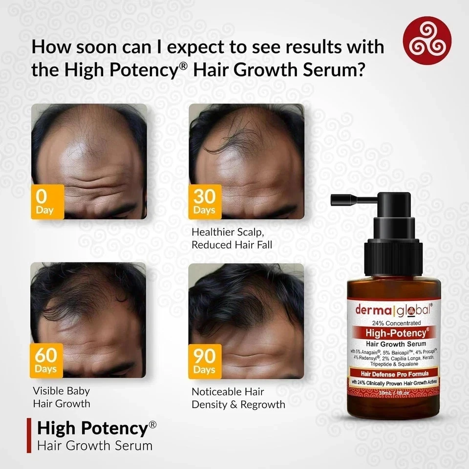 Derma Global Hair Growth Serum - Advanced Hair Loss Treatment - 1 Bottle