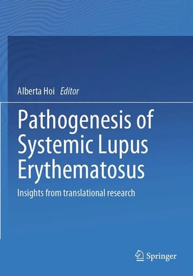 Alberta Hoi | Pathogenesis of Systemic Lupus Erythematosus | Taschenbuch (2022)