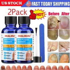 2x 30ml Antibacterial Fungal Nail Treatment Nail Repair Essential Oil Serum US