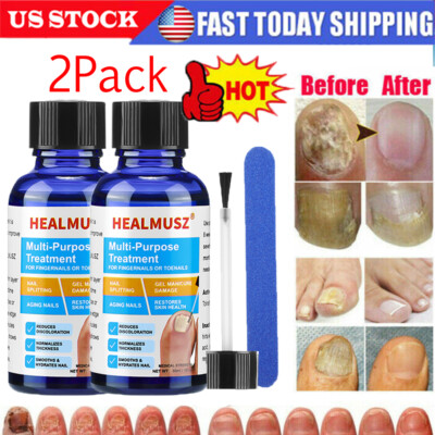 2x 30ml Antibacterial Fungal Nail Treatment Nail Repair Essential Oil Serum US