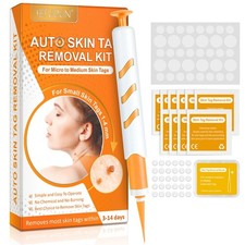 Auto Skin Tag Removal Kit Micro Skin Tag Remover Tool Skin Tag Remover Device