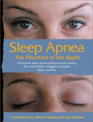 Sleep Apnea--The Phantom of the Night : Overcome Sleep Apnea Synd