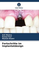 Arti Mishra (U. A.) | Fortschritte Im Implantatdesign | Taschenbuch | Deutsch