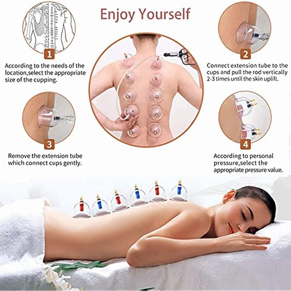 12 Cups Chinese Cupping Set Vacuum Suction Cups for Pain Relief Physical Therapy - Image 4 of 4