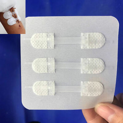 3er Pack Notfallset hämostatisch selbstklebend Reißverschluss binden Reißverschluss Stiche Pflaster weiß