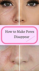 cream for open pores