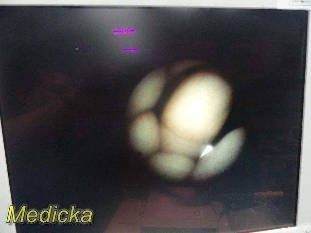 Rinocerontescopio Flexible Karl Storz 11001H con Estuche OF-S1 ETO Tapa PROBADO ~ 37994 Foto 4 de 4