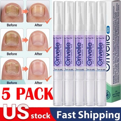 1-5PCS Anti Fungal Pen Intensive Treatment Toenail Fungus Foot Nail Repair Oil