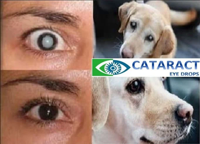 CATARACT CLEAR Holistic, chemical & additive free cataract eye drops for people and animals