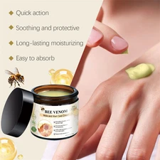 Bee Venom Skin Tag Removal Treatment Cream Body Care Mole Corn Wart Remover