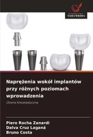 Piero Rocha Zanardi (U. A.) | Napr¿¿Enia Wokó¿ ImplantóW Przy Ró¿Nych...
