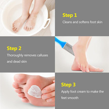 4 Pcs Pedicure Foot Files Callus Remover with Double Sided Feet Rasp for Dead...