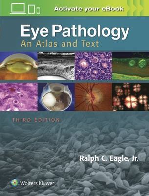 Eye Pathology : An Atlas and Text, Hardcover by Eagle, Ralph C., Jr., M.D., U...
