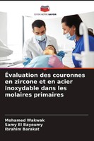 Mohamed Wakwak (U. A.) | ÉValuation Des Couronnes En Zircone Et En Acier...