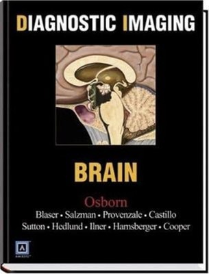 Brain Hardcover Anne G., Blaser, Susan I., Salzman, Karen L. Osbo