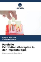 Anuraj Vijayan (U. A.) | Partielle Extraktionstherapien In Der Implantologie