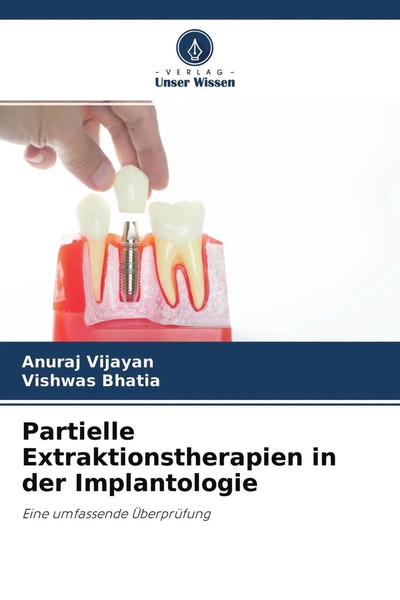 Anuraj Vijayan (U. A.) | Partielle Extraktionstherapien In Der Implantologie-image