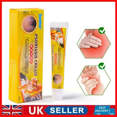 Psoriasis Cream For Bacteriostasis Dermatitis Eczema Body Psoriasis Skin Care
