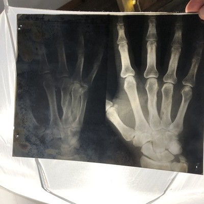 Vintage 1940s 50s Hand X-Ray Medical Anatomy Gothic Decor Kodak Skeleton Art