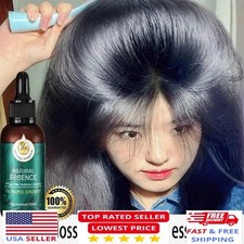 Hair Fast Growth And Care Essential Oil Natural Ginger Hair Regrowth Products 