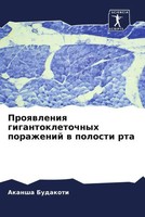 Akansha Budakoti | Proqwleniq Gigantokletochnyh Porazhenij W Polosti Rta | Buch