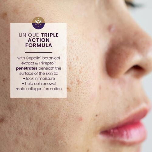 Mederma Intensive.Overnight Scar Removal Cream Skin Growth/Repair Night Use - Picture 8 of 16