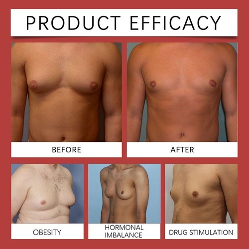 Gynecomastia Cellulite Melting Patch, Chest Belly Fat Remove for Men best |U.S - Picture 14 of 16