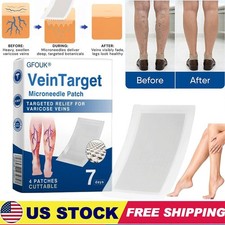 VeinTarget Microdarts Patch for Leg Discomfort  Moisture Legs Varicose Veins