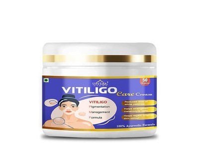 Vitiligo Cream 50gm - Effective Herbal Formula for White Patches & Skin Repair