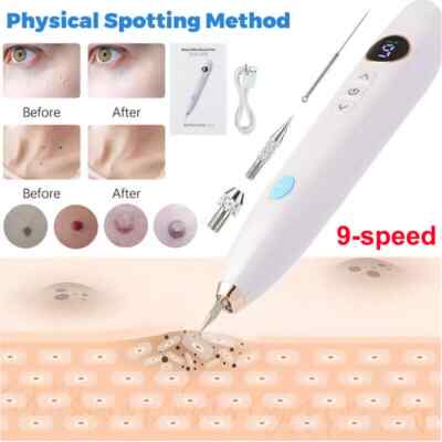 LCD Laser Plasma Skin Tag Remover Age Spot Pen Mole Wart Tattoo Removal Machine