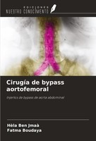 CirugíA De Bypass Aortofemoral HèLa Ben Jmaà