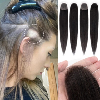 SEGO Human Hair Patches Pieces Full Lace Base Cover Bald Spots for Alopecia Areata