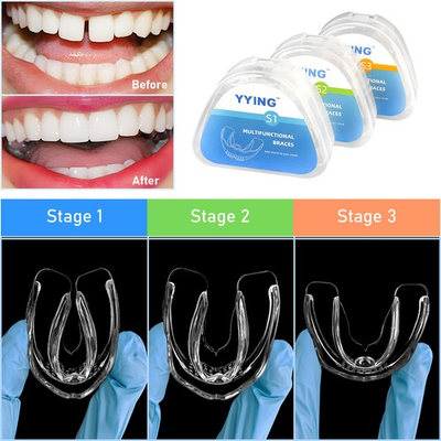 #ad 3 Stage Dental Orthodontic Teeth Corrector Braces Tooth Straightening Retainer $12.34