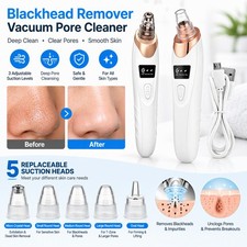 Electric Blackhead Remover Pore Vacuum Face Cleaner Pimple Removal with 5 Heads