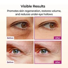 DR. MELAXIN Cemenrete Calcium Balm Stick Anti-Wrinkle Firming Moisturizer - Image 2