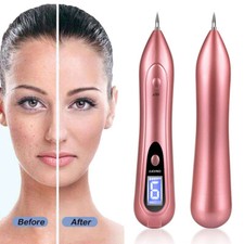USB Laser Plasma Pen Mole Removal Dark Spot Remover Skin Wart Tag Tattoo