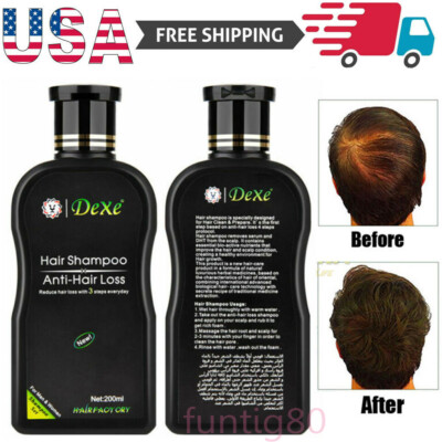 DEXE Anti-Hair Loss Shampoo Chinese Herbal Hair Regrowth For Men & Women 200ml