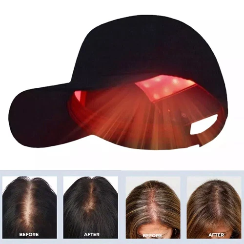 Red Light Therapy Hat 650nm&850nm Hair Loss Treatment Cap Hair Growth Regrowth - Picture 2 of 13