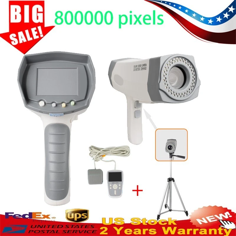 Cámara vaginal electrónica digital Carejoy 480K 800K 850K píxeles SONY Foto 3 de 4